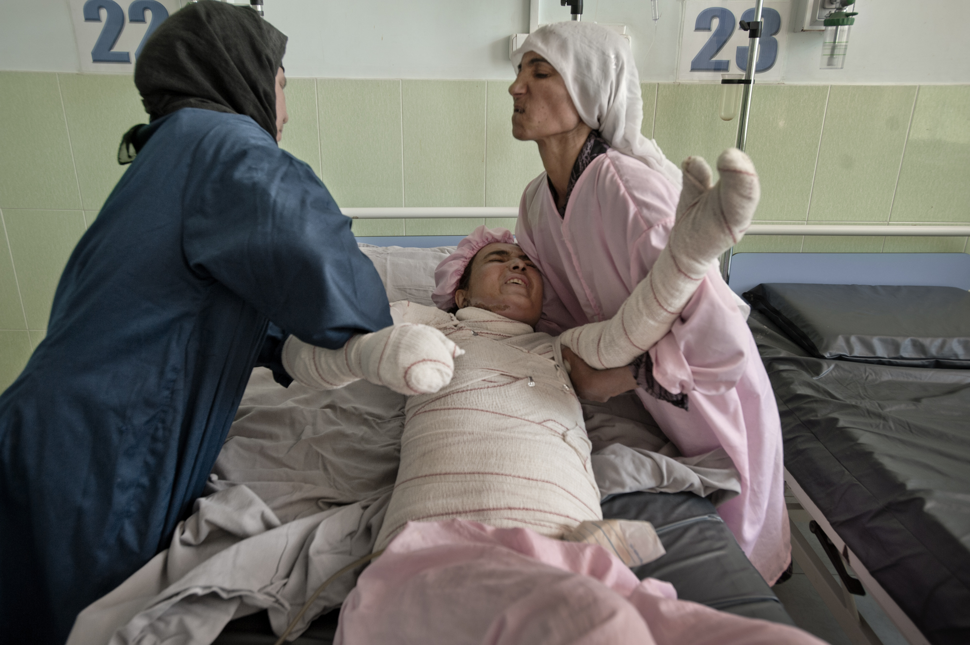 Fátima, mujer afgana en el hospital, donde intentaron salvarla tras quemarse viva.