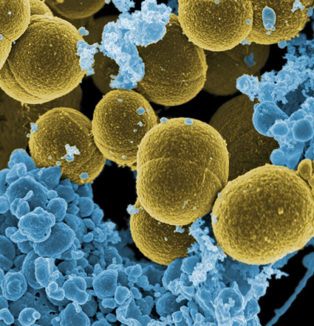 Resistant Staphylococcus aureus (Author: NIH)