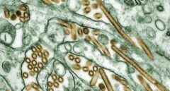 La OMS confirma la transmisión  de gripe aviar A(H5N1) en humanos en Camboya