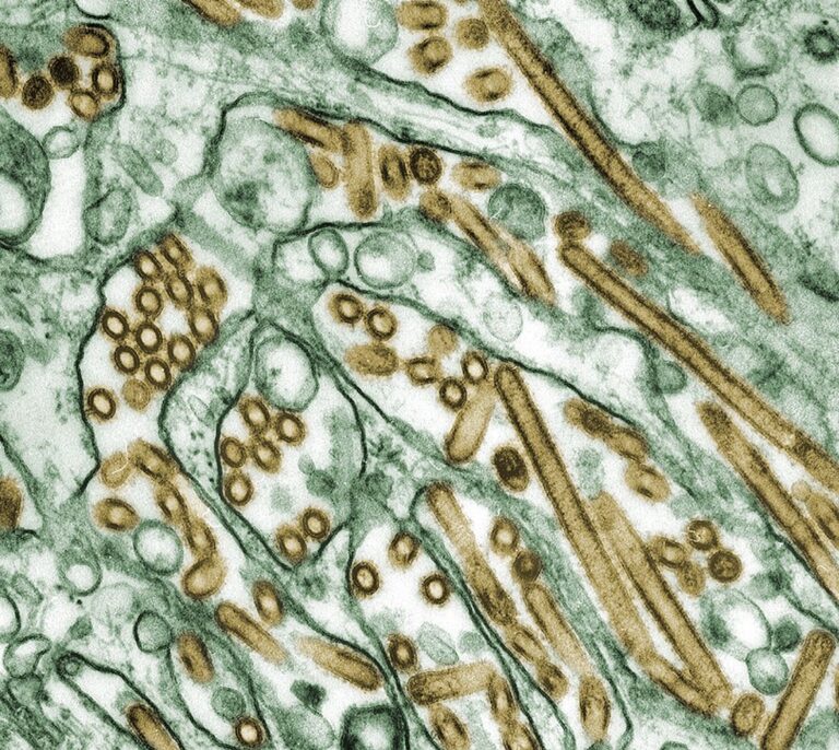 La OMS confirma la transmisión  de gripe aviar A(H5N1) en humanos en Camboya