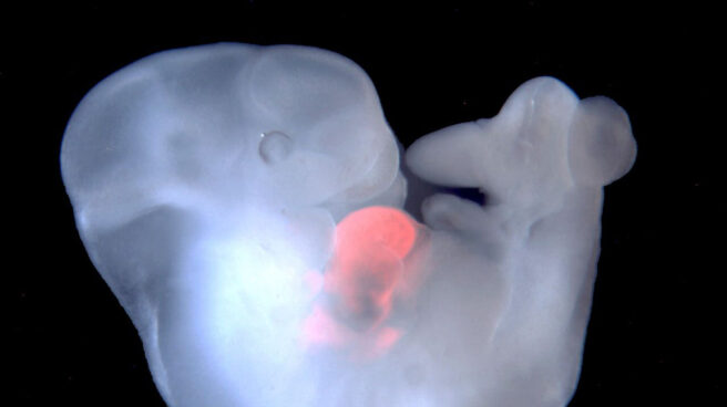 Crean embriones mezcla de cerdo y humano para cultivar órganos para trasplantes