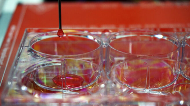 CIENTÍFICOS ESPAÑOLES DISEÑAN UNA BIOIMPRESORA 3D DE PIEL HUMANA Un equipo de ciéntificos crea piel humana con una bioimpresora 3D.