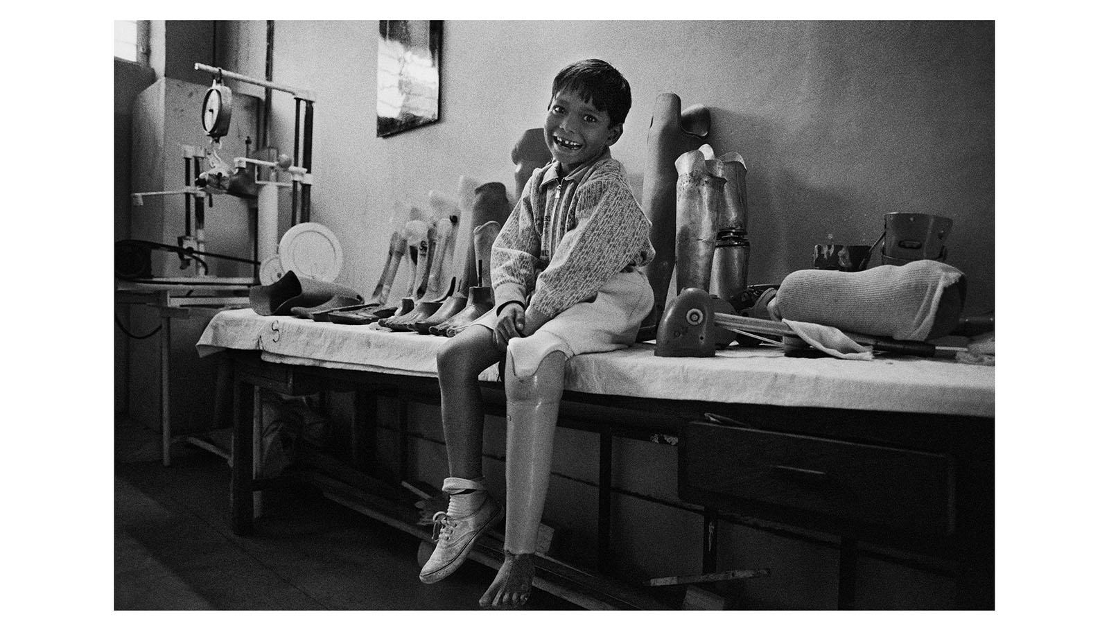 El pie de Jaipur es una prótesis desarrollada en los años 40 en esta región de la India por el Dr. Sethi. Cuando se tomó esta fotografía, el mecanismo costaba tan sólo 4 dólares y se consideraba el más eficaz para quienes viven en países en vías de desarrollo.