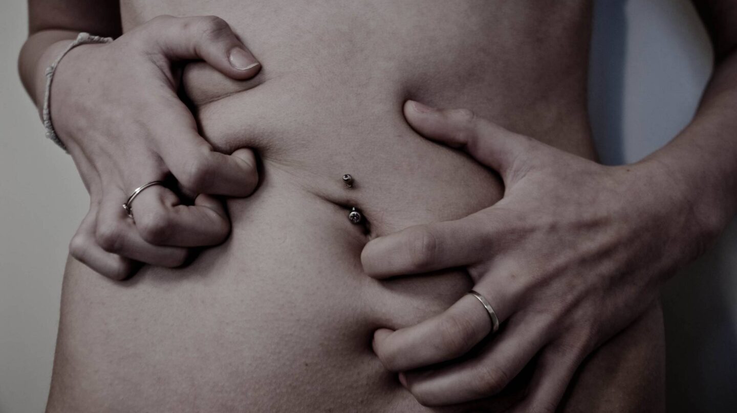 En la actualidad se estima que una de cada 100 adolescentes padece anorexia nerviosa y cuatro de cada 100 bulimia nerviosa, según Cruz Roja.