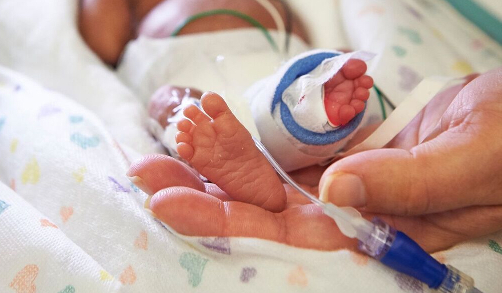 Bebé prematuro en el hospital