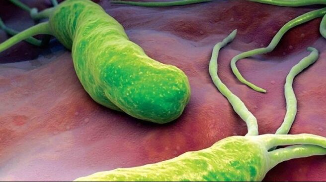 Bacteria estomacal h.pylori Bacteria estomacal h.pylori