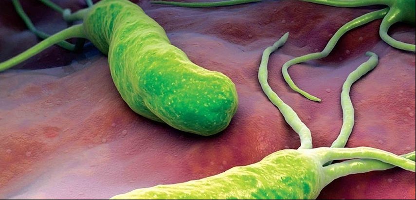 Bacteria estomacal h.pylori
