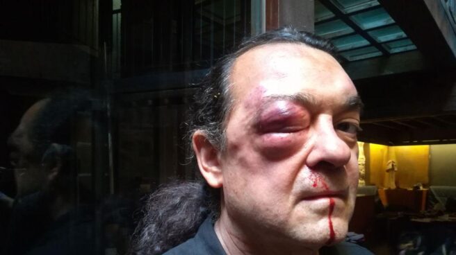 El líder de la corriente Imagina Podemos en Castilla-La Mancha, Fernando Barredo, tras ser agredido.