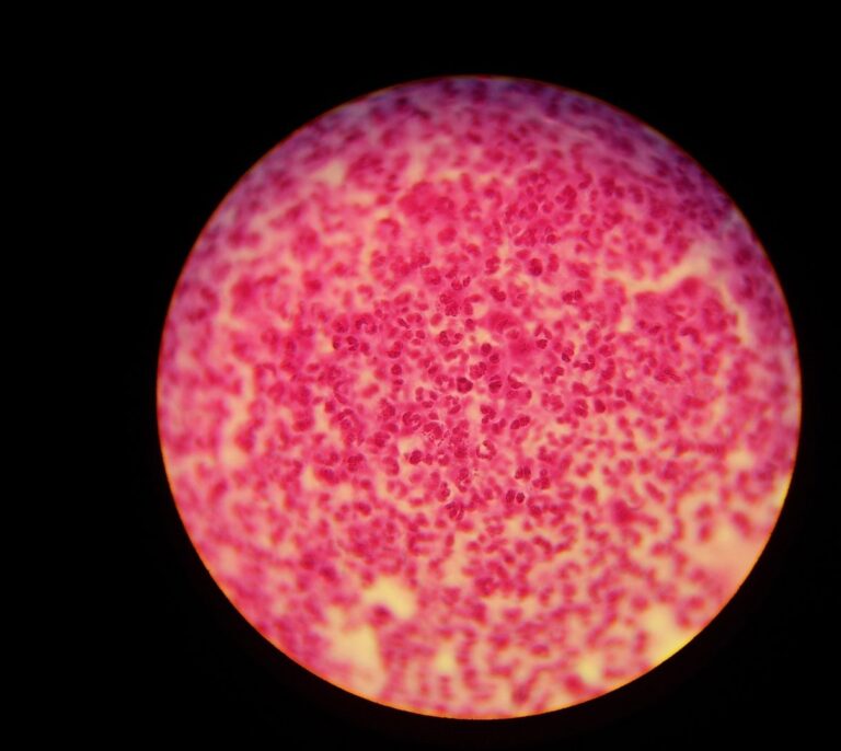 La OMS alerta de un nuevo tipo de gonorrea resistente a antibióticos