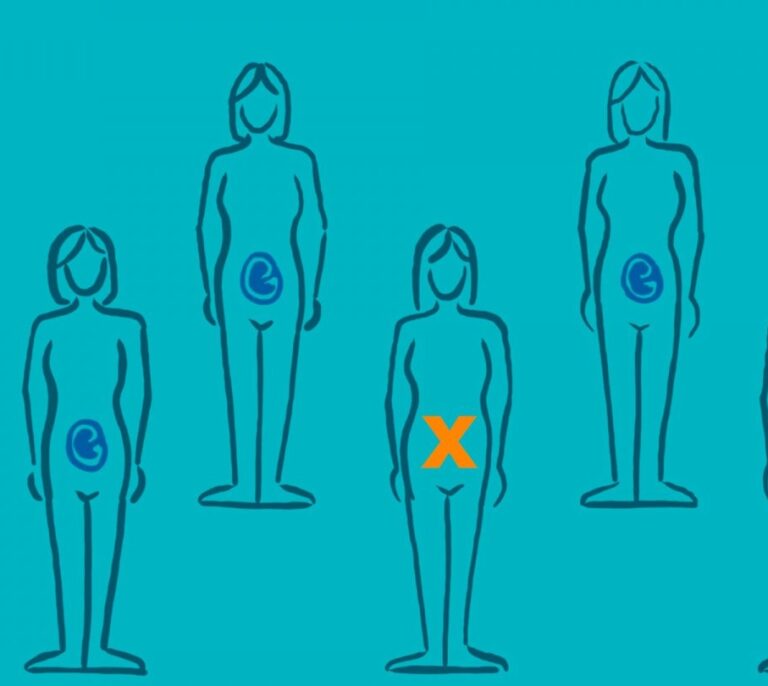 Los inconvenientes de la reproducción sexual