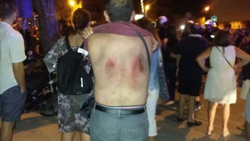 Un manifestante herido en Murcia, junto al paso a nivel