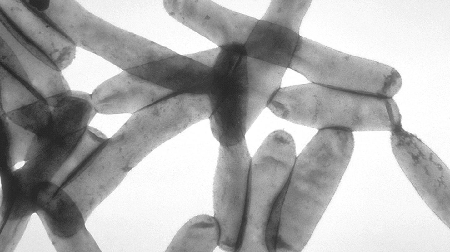 Legionella