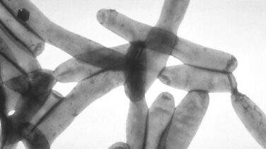 Dos muertos por un brote de legionella en la localidad barcelonesa de Llinars del Vallès