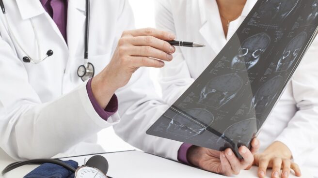 ictus Un médico muestra una prueba craneal.