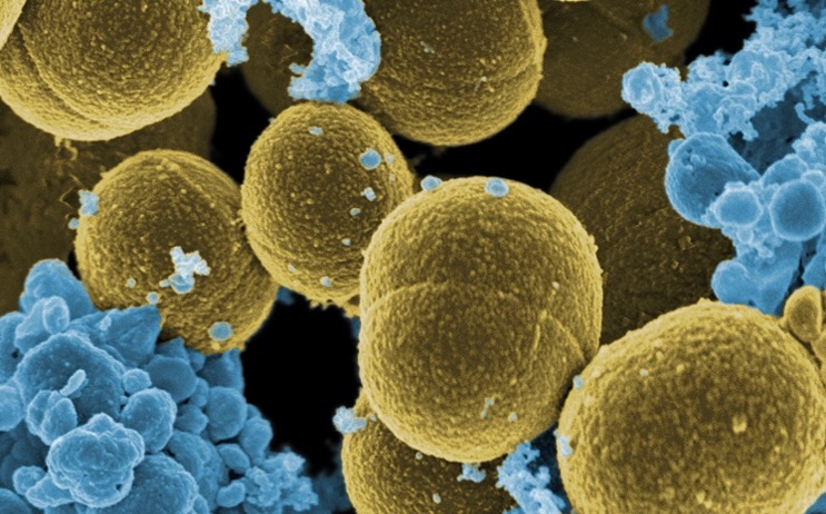 Staphylococcus aureus