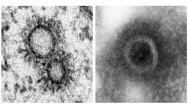 Un nuevo hallazgo sobre el virus abre la puerta a una “pastilla contra la gripe”