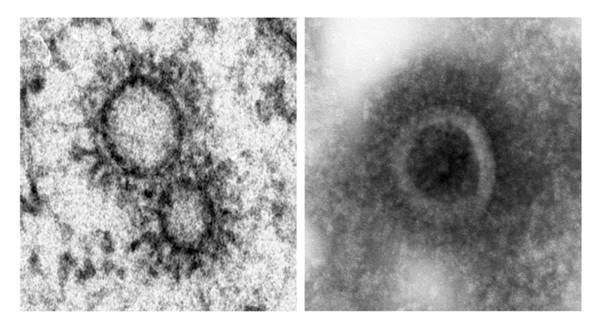 Investigadores del CSIC y el Instituto Pasteur han descubierto que el virus construye sus propios orgánulos para transportar la infección, al contrario de lo que se creía.