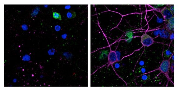 Descubren un proceso contra la muerte neuronal que causan el Alzheimer o los ictus