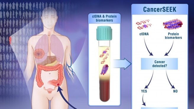 CancerSeek es un análisis de sangre que detecta hasta ocho tipo de cáncer.