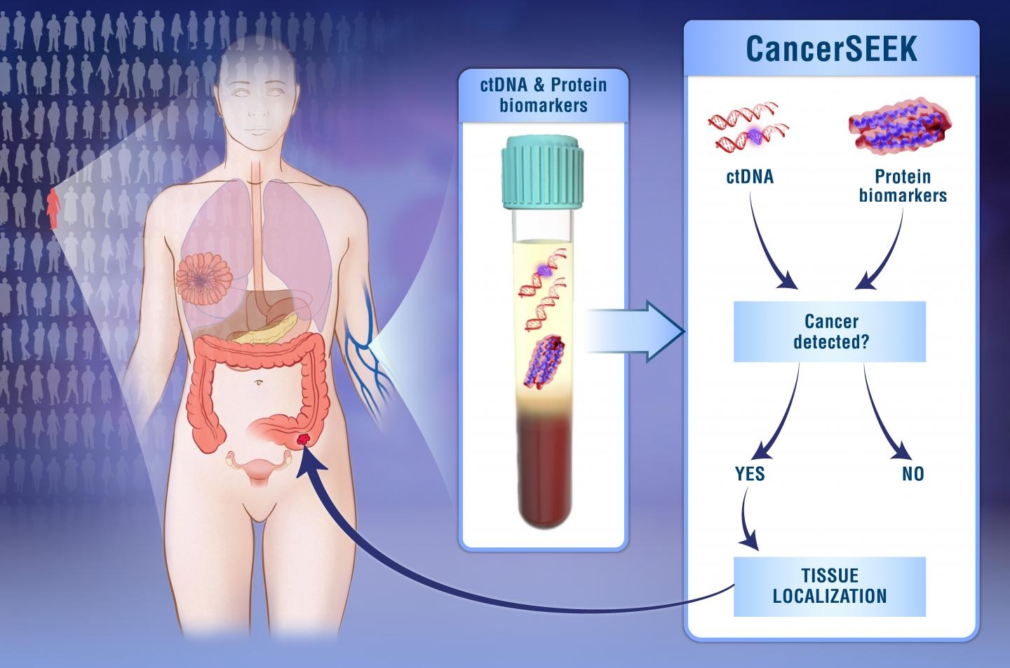 CancerSeek es un análisis de sangre que detecta hasta ocho tipo de cáncer.
