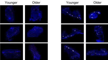 Un estudio afirma que los mayores generan tantas nuevas neuronas como los jóvenes