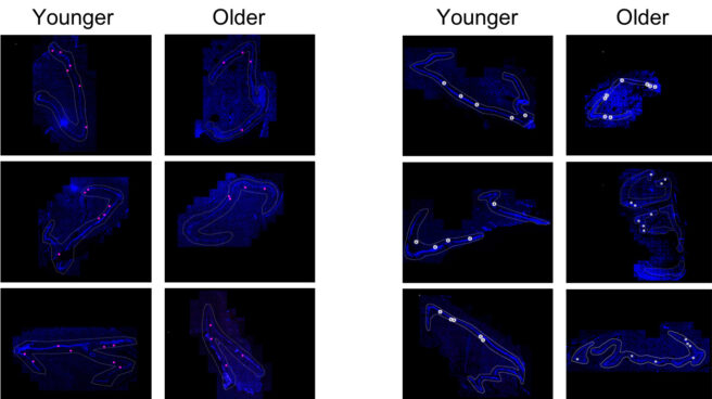 Un estudio afirma que los mayores generan tantas nuevas neuronas como los jóvenes