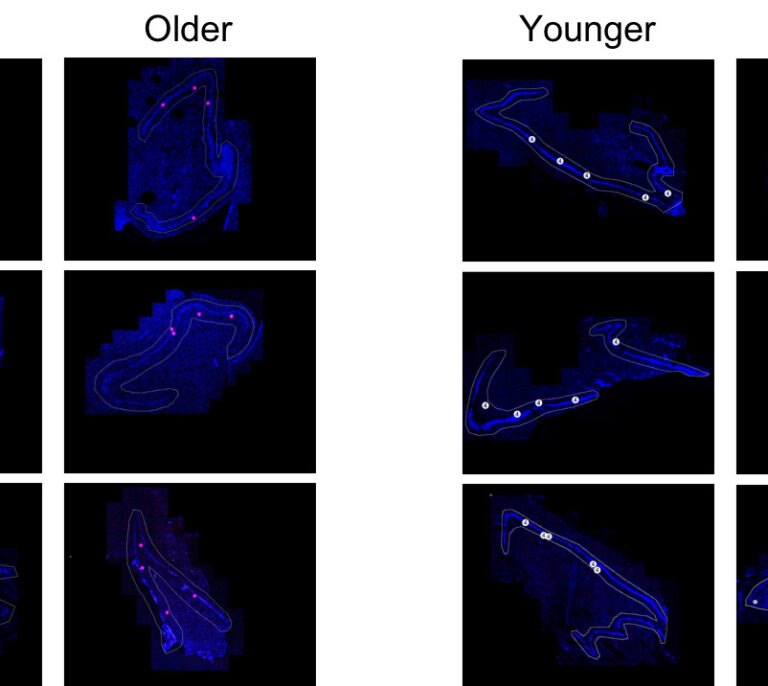 Un estudio afirma que los mayores generan tantas nuevas neuronas como los jóvenes