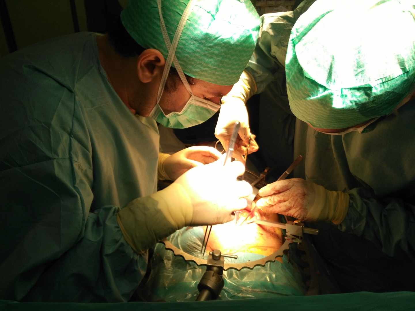 Los trasplantes renales de vivo alcanzarán un nuevo hito este año con los trasplantes cruzados internacionales.