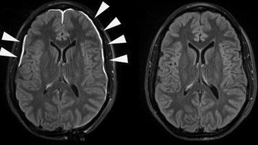Así se recupera tu cerebro tras un golpe en la cabeza