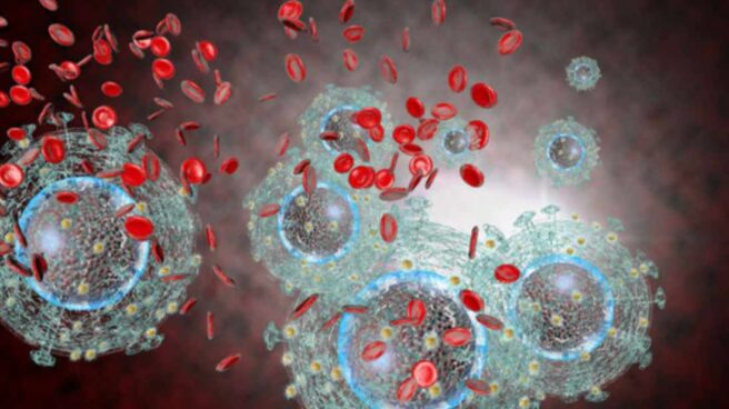vih El VIH daña el sistema inmunitario mediante la destrucción de los glóbulos blancos que combaten las infecciones.