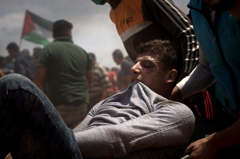 Un palestino herido en las protestas por el traslado de la embajada de EEUU a Jerusalén.