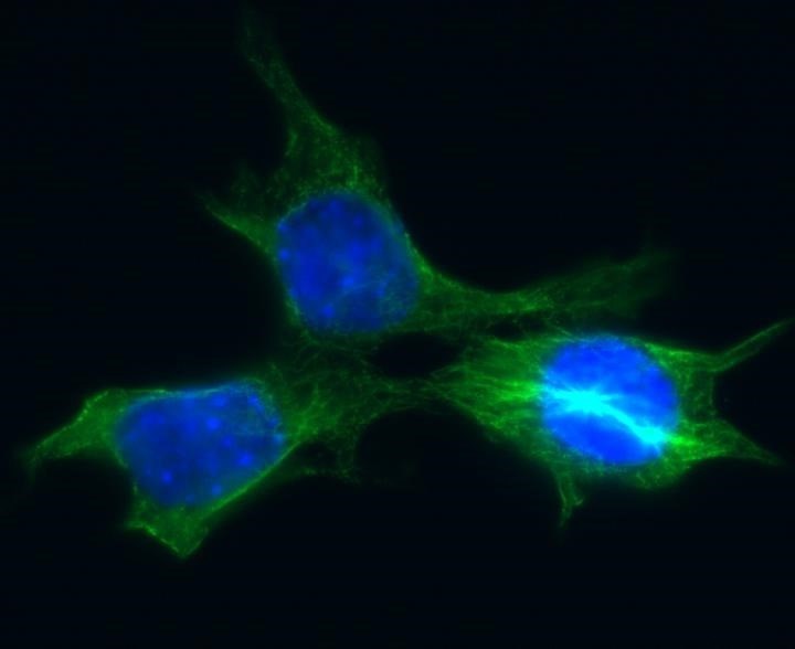 Las células tumorales evitan la muerte a través de la reparación in extremis del ADN
