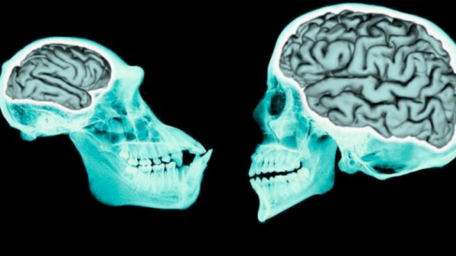 Comparación entre el cerebro de un chimpancé Comparación entre el cerebro de un chimpancé