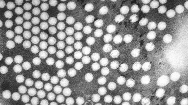 La OMS avisa del riesgo de que la polio se vuelva a propagar en Europa