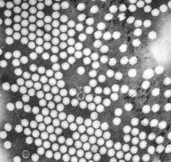 La OMS avisa del riesgo de que la polio se vuelva a propagar en Europa