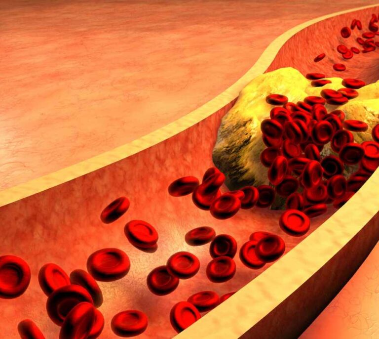 Edición genética contra el colesterol malo