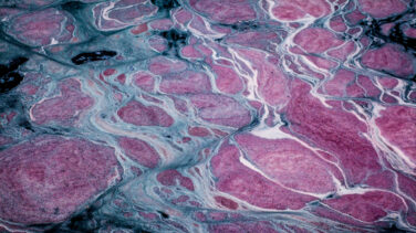 Poliéster criminal: un millón de microplásticos en un solo lavado