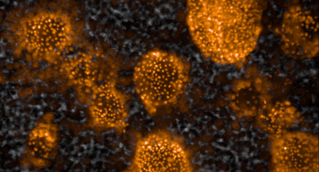 Células madre convertidas en tejido hepático, al microscopio