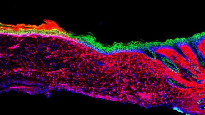 El equipo de Izpisúa consigue regenerar piel reprogramando células en una herida