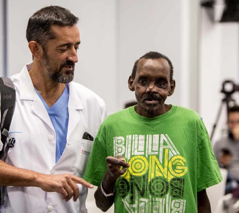El doctor Cavadas reconstruye el rostro a un paciente keniano atacado por una hiena