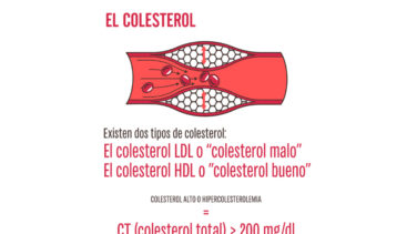 La acumulación de colesterol aumenta el tumor en el cáncer de páncreas