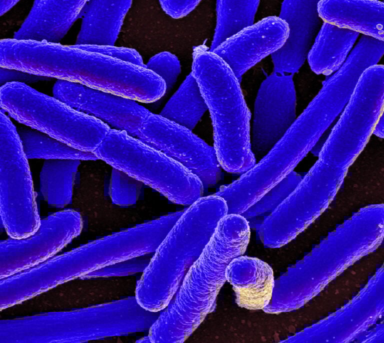 Las tres bacterias y un parásito que perpetúan la pobreza y la desigualdad en el mundo