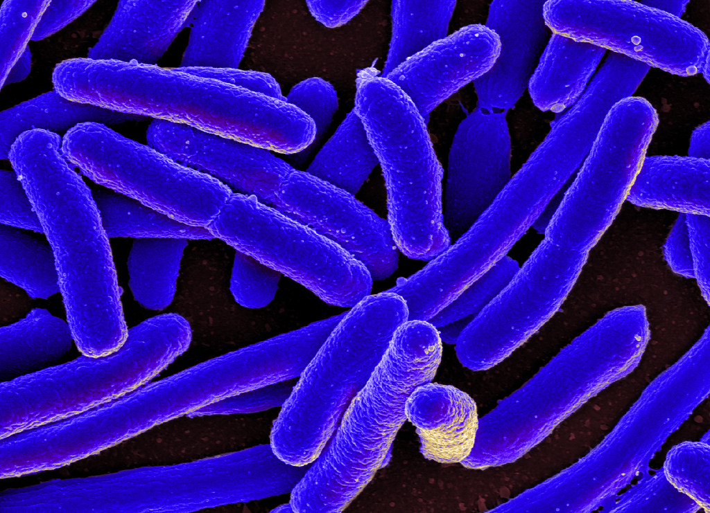 Bacteria e coli.