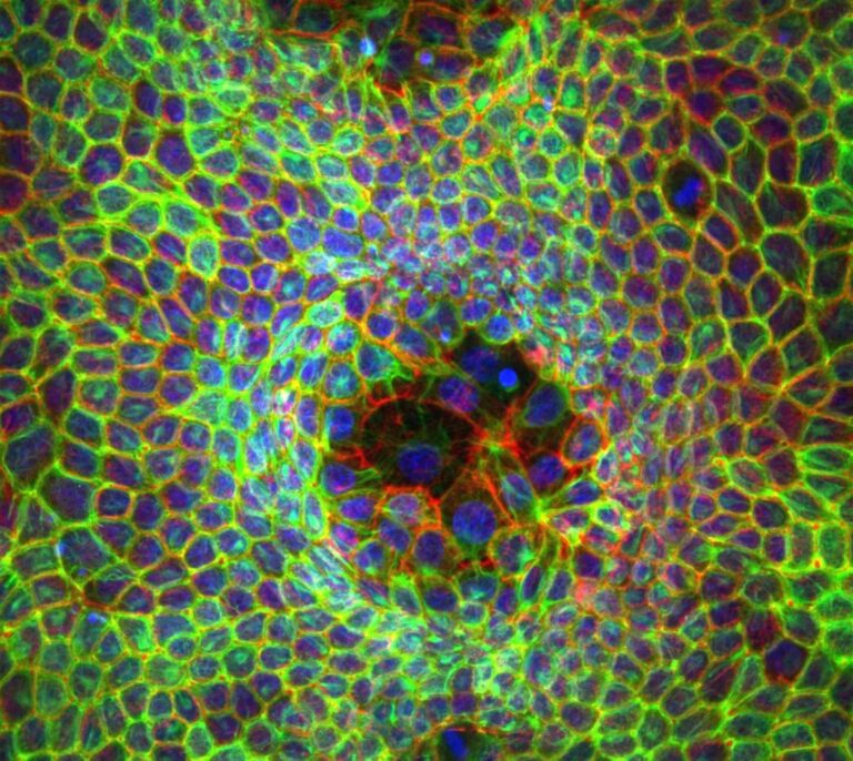 Investigadores españoles descubren células superdeformables