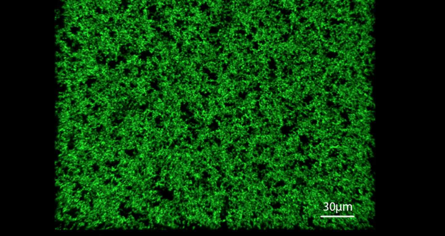 Este 'césped' es la estructura porosa de proteínas sobre la que pueden crecer tejidos humanos