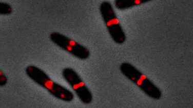 Científicos españoles encuentran la manera de frenar bacterias multirresistentes
