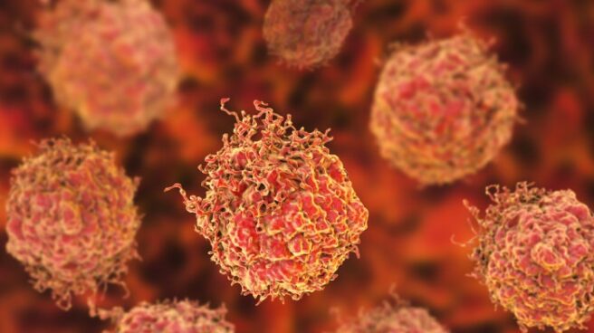 Célula en el Cáncer de Próstata Célula cancerígena.