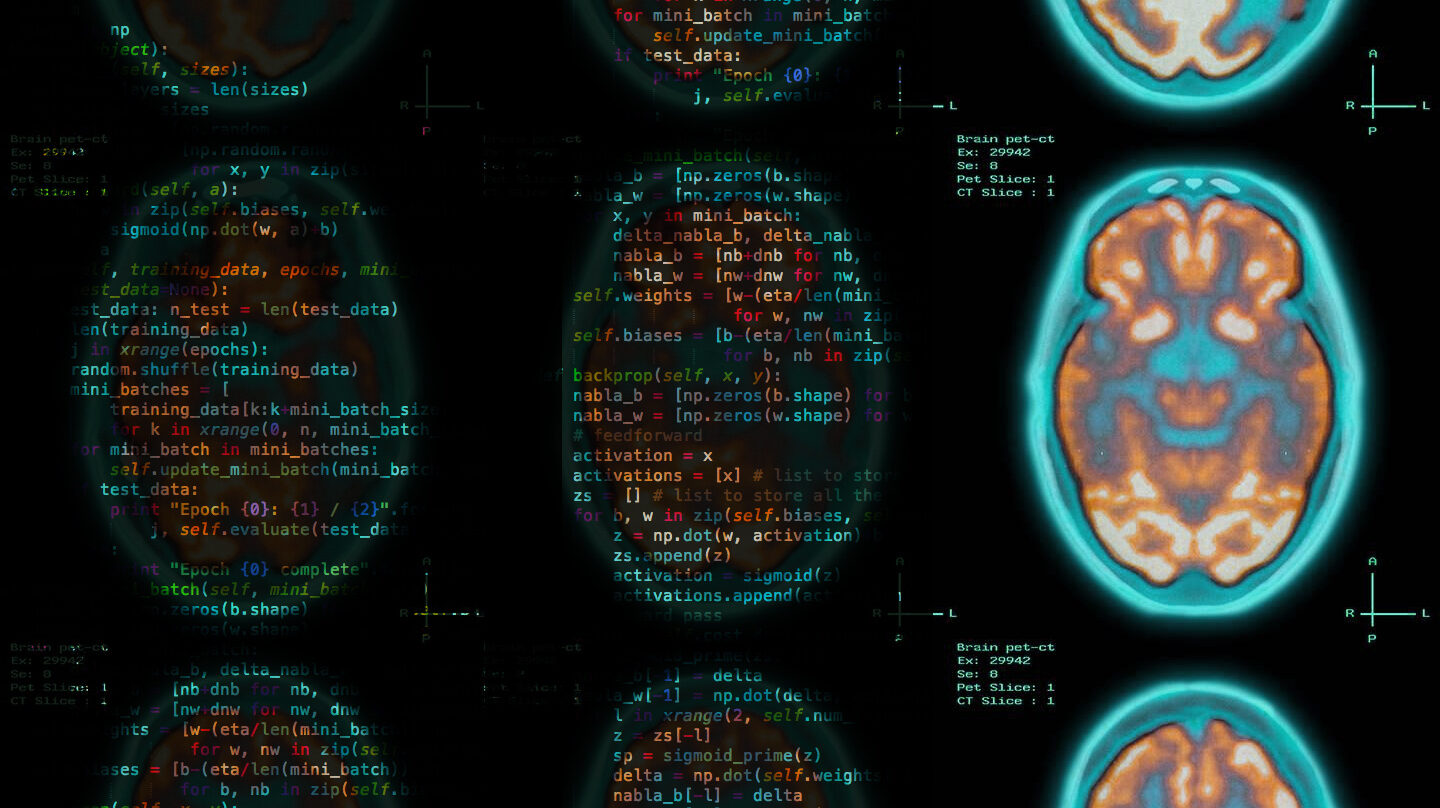 Computación, inteligencia artificial y cerebro