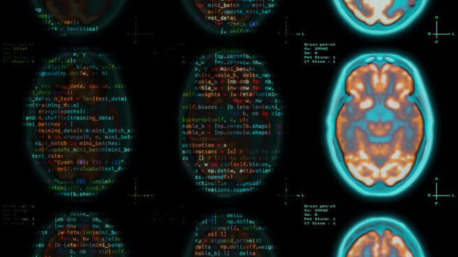 La inteligencia artificial consigue anticipar si tendrás alzhéimer