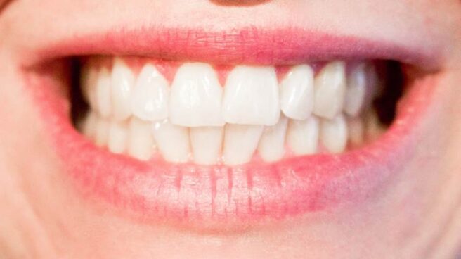 Nuevas nanopartículas permiten remineralizar los dientes